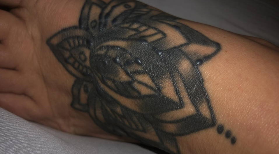 Can You Put Tattoo Over Small Acnes? • Changemakers Unite 2023 Can You Put Tattoo Over Small Acnes? • Changemakers Unite 2023